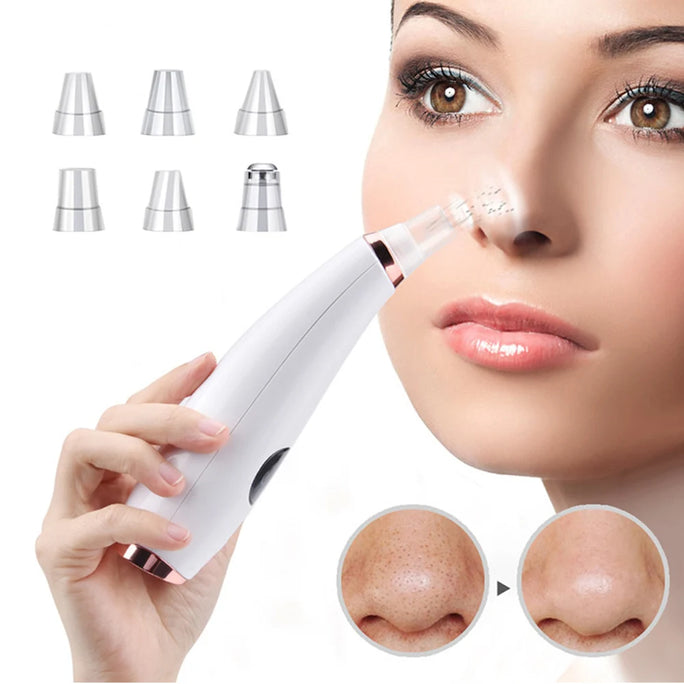 Acne & Blackhead Vacuum – Skin Cleaner