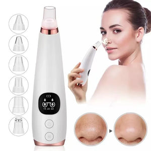 Acne & Blackhead Vacuum – Skin Cleaner