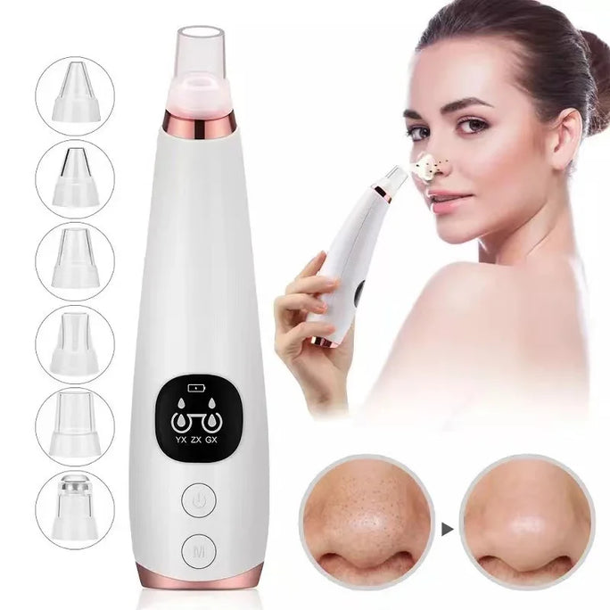 Acne & Blackhead Vacuum – Skin Cleaner